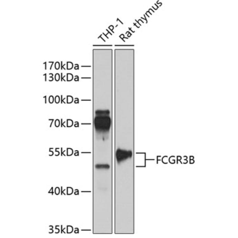 Western Blot - Anti-CD16b Antibody (A90217) - Antibodies.com