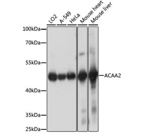 Western Blot - Anti-ACAA2 Antibody (A90218) - Antibodies.com