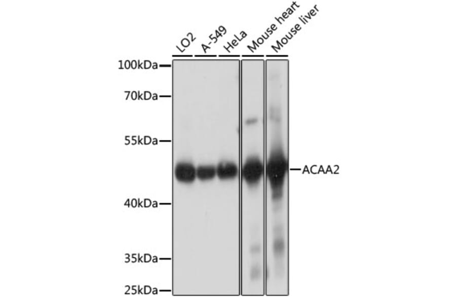Western Blot - Anti-ACAA2 Antibody (A90218) - Antibodies.com