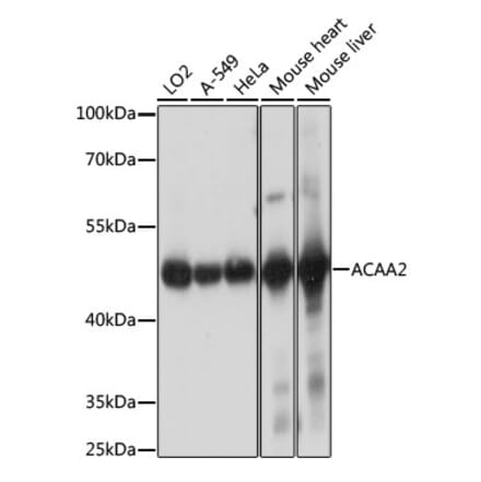 Western Blot - Anti-ACAA2 Antibody (A90218) - Antibodies.com