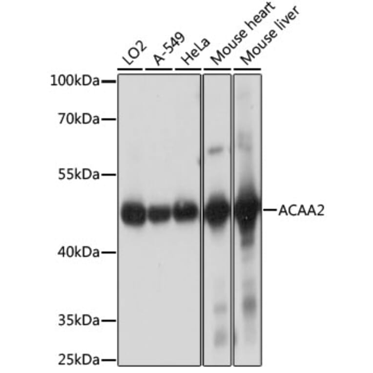 Western Blot - Anti-ACAA2 Antibody (A90218) - Antibodies.com