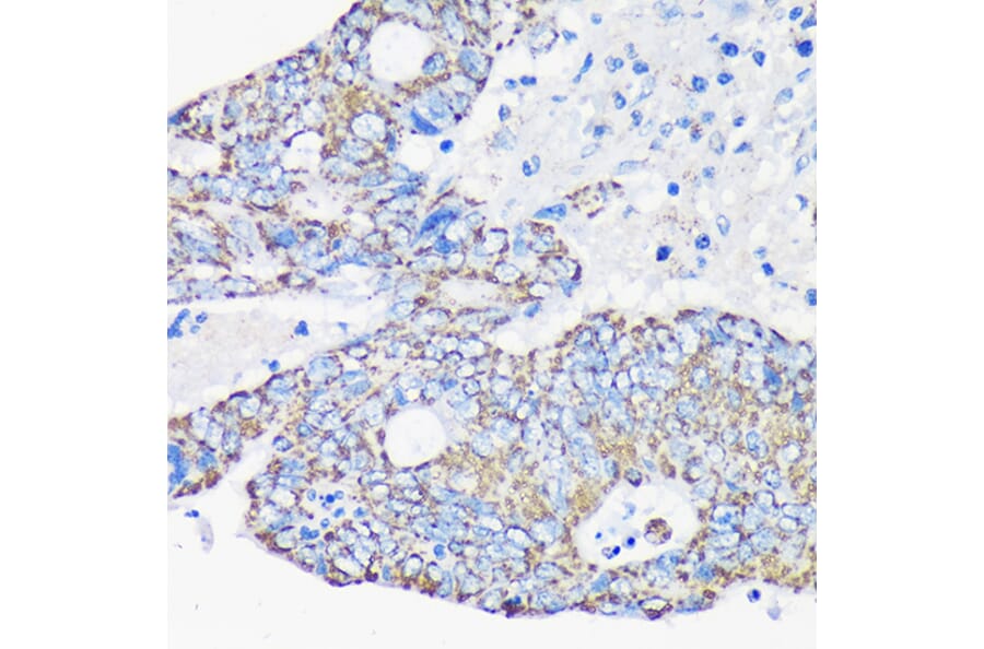 Immunohistochemistry - Anti-ACAA2 Antibody (A90218) - Antibodies.com