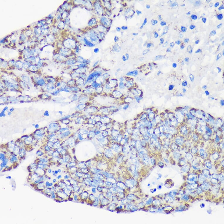 Immunohistochemistry - Anti-ACAA2 Antibody (A90218) - Antibodies.com