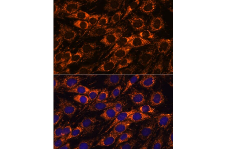 Immunofluorescence - Anti-ACAA2 Antibody (A90218) - Antibodies.com