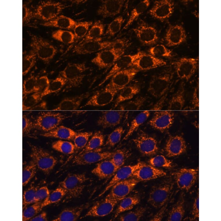 Immunofluorescence - Anti-ACAA2 Antibody (A90218) - Antibodies.com