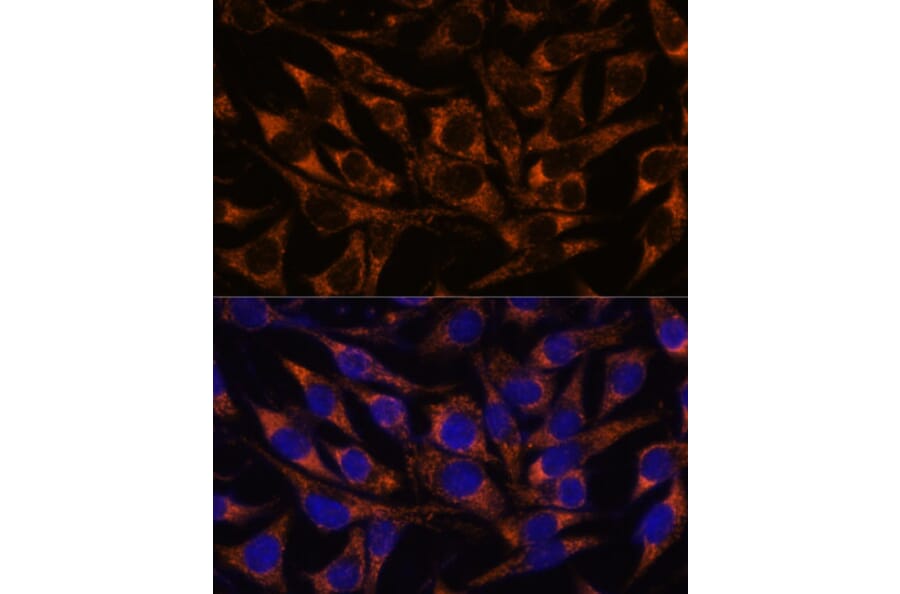Immunofluorescence - Anti-ACAA2 Antibody (A90218) - Antibodies.com