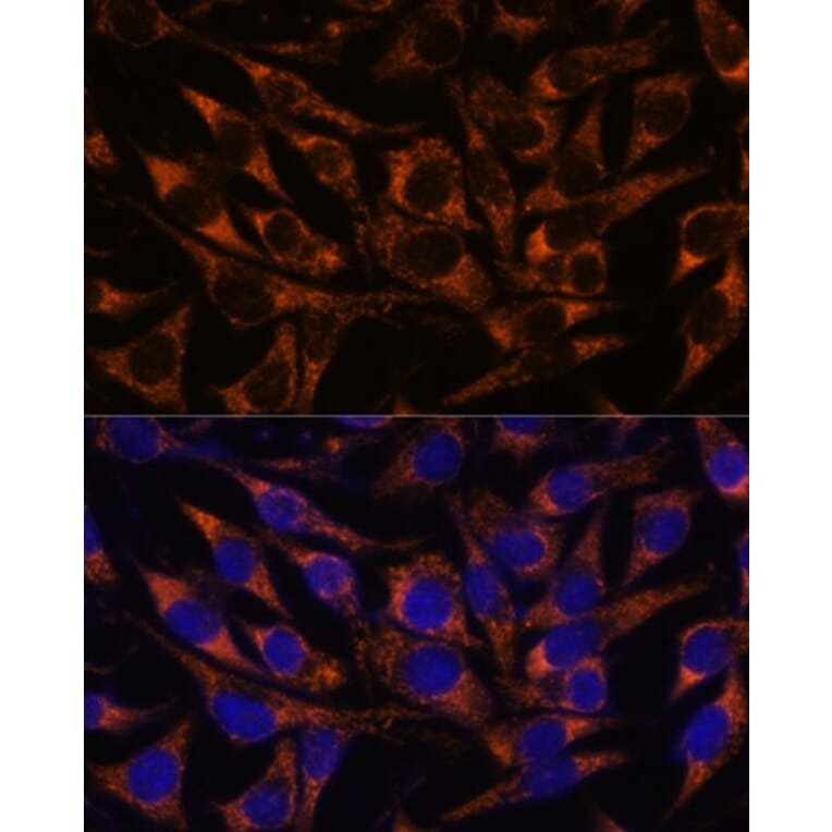 Immunofluorescence - Anti-ACAA2 Antibody (A90218) - Antibodies.com