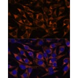 Immunofluorescence - Anti-ACAA2 Antibody (A90218) - Antibodies.com