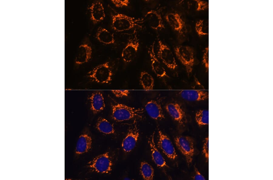 Immunofluorescence - Anti-ACAA2 Antibody (A90218) - Antibodies.com