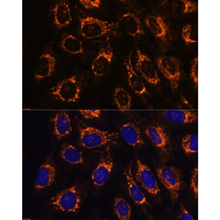 Immunofluorescence - Anti-ACAA2 Antibody (A90218) - Antibodies.com