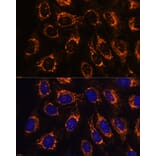 Immunofluorescence - Anti-ACAA2 Antibody (A90218) - Antibodies.com