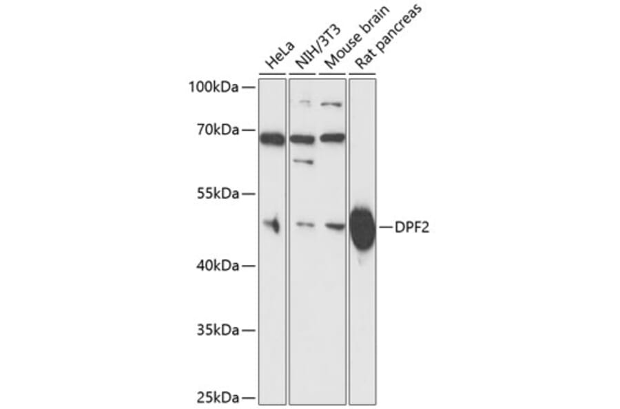 Western Blot - Anti-DPF2 Antibody (A13271) - Antibodies.com