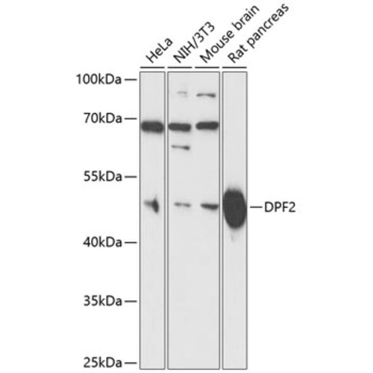 Western Blot - Anti-DPF2 Antibody (A13271) - Antibodies.com