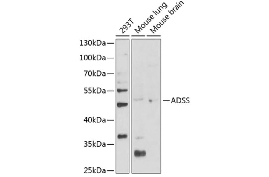 Western Blot - Anti-AdSS 2 Antibody (A90220) - Antibodies.com