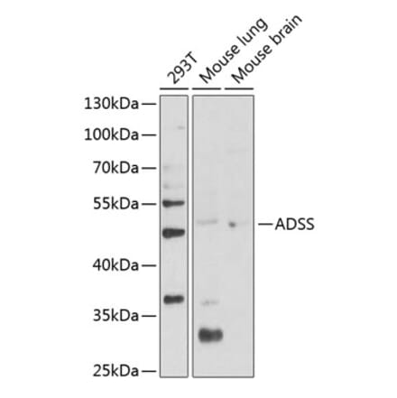 Western Blot - Anti-AdSS 2 Antibody (A90220) - Antibodies.com