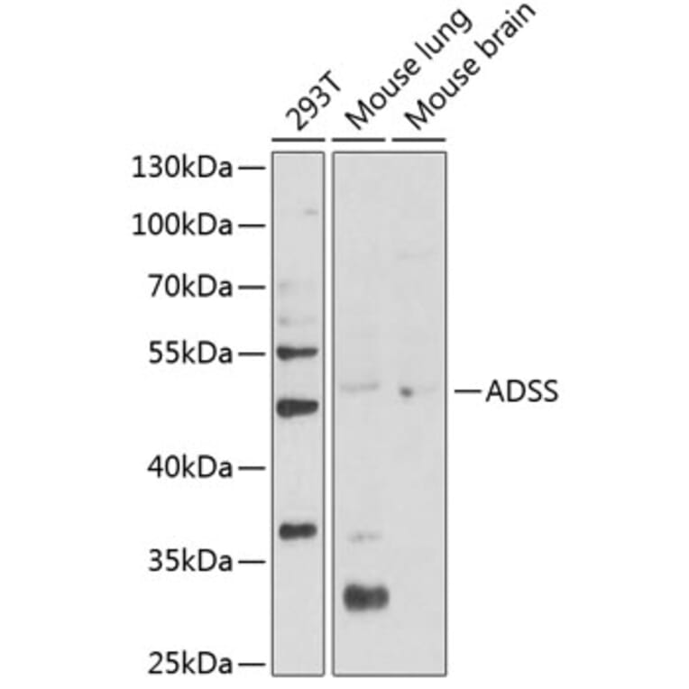 Western Blot - Anti-AdSS 2 Antibody (A90220) - Antibodies.com