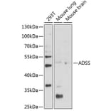 Western Blot - Anti-AdSS 2 Antibody (A90220) - Antibodies.com