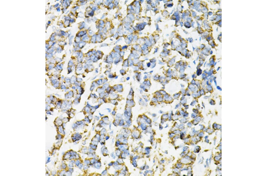 Immunohistochemistry - Anti-AdSS 2 Antibody (A90220) - Antibodies.com