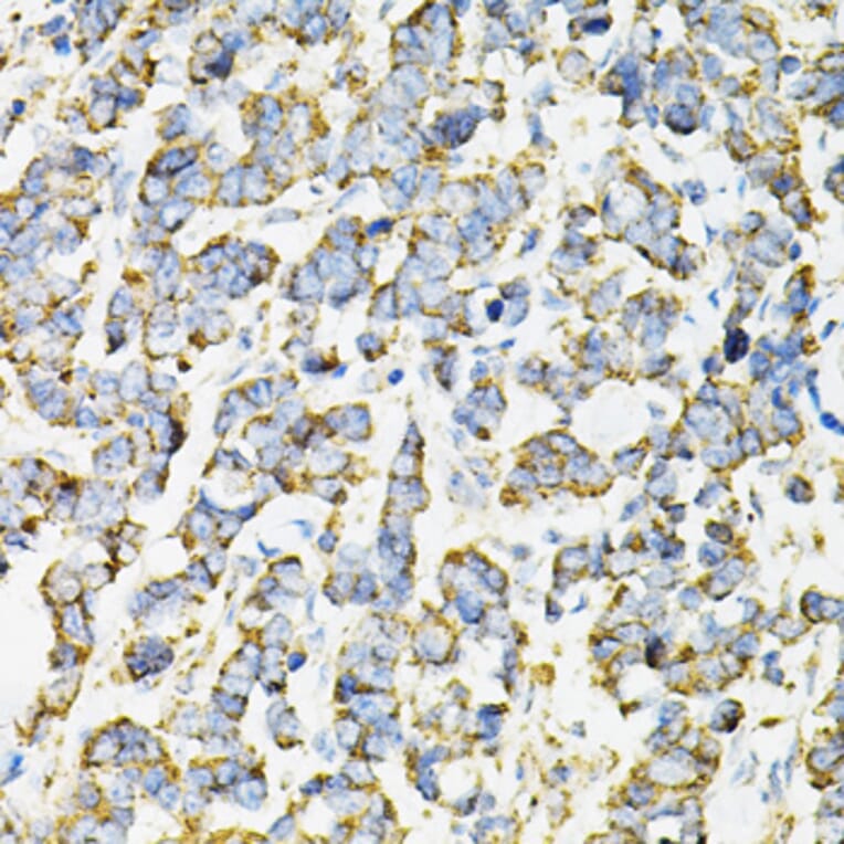 Immunohistochemistry - Anti-AdSS 2 Antibody (A90220) - Antibodies.com