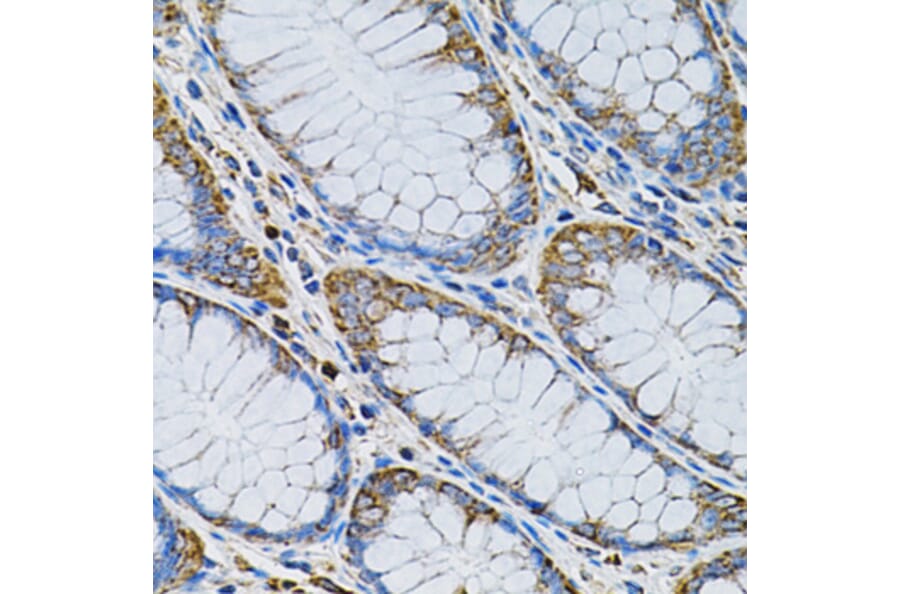 Immunohistochemistry - Anti-AdSS 2 Antibody (A90220) - Antibodies.com