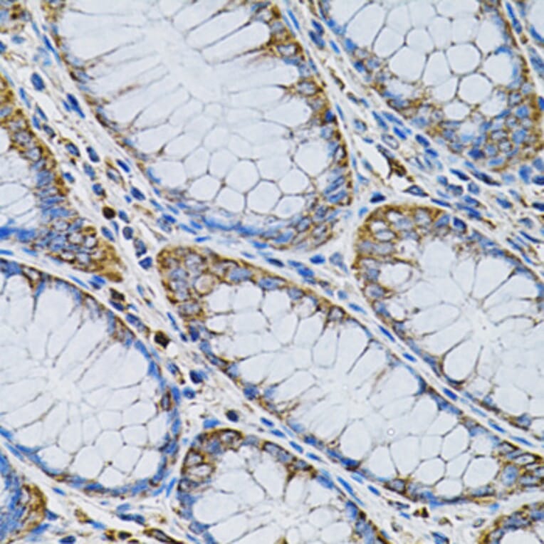 Immunohistochemistry - Anti-AdSS 2 Antibody (A90220) - Antibodies.com