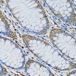Immunohistochemistry - Anti-AdSS 2 Antibody (A90220) - Antibodies.com