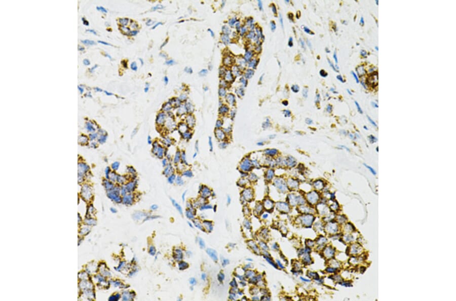 Immunohistochemistry - Anti-AdSS 2 Antibody (A90220) - Antibodies.com