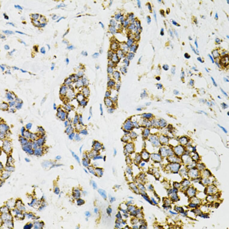 Immunohistochemistry - Anti-AdSS 2 Antibody (A90220) - Antibodies.com