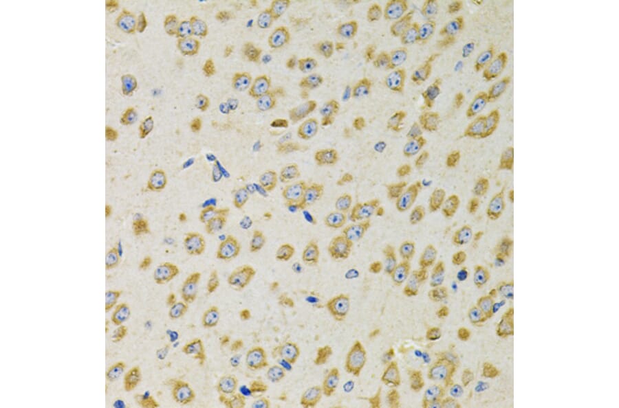 Immunohistochemistry - Anti-AdSS 2 Antibody (A90220) - Antibodies.com