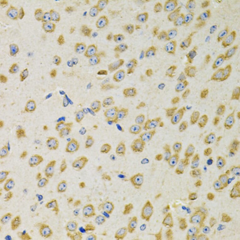 Immunohistochemistry - Anti-AdSS 2 Antibody (A90220) - Antibodies.com