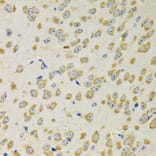 Immunohistochemistry - Anti-AdSS 2 Antibody (A90220) - Antibodies.com
