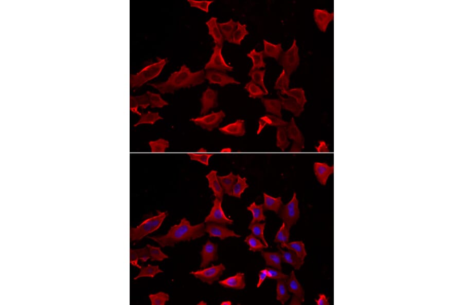 Immunofluorescence - Anti-AdSS 2 Antibody (A90220) - Antibodies.com