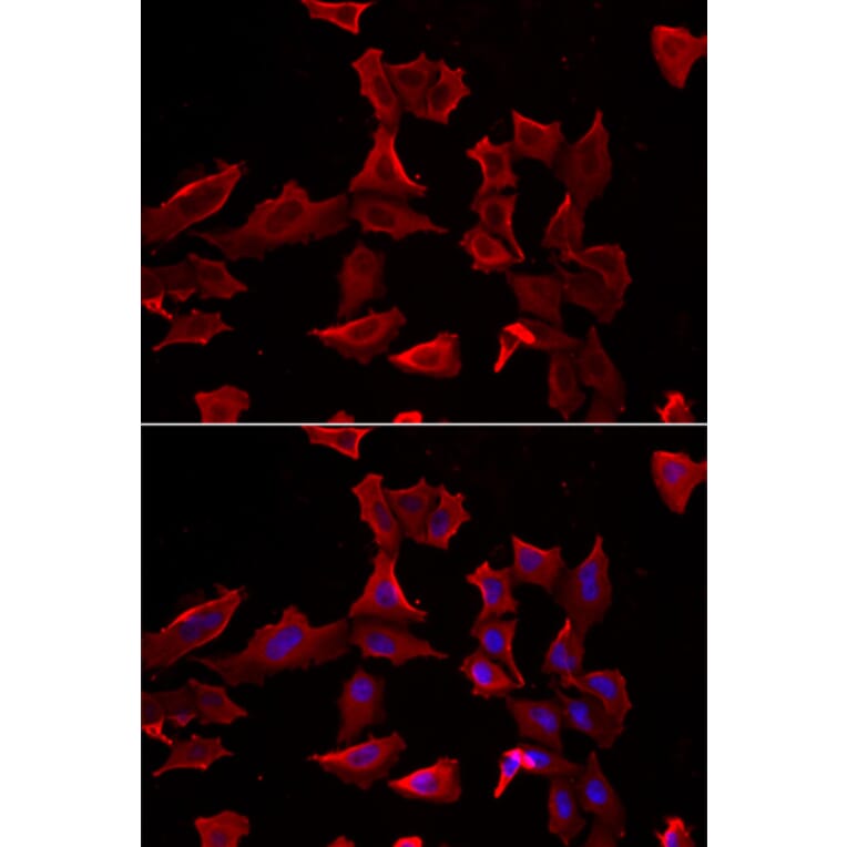 Immunofluorescence - Anti-AdSS 2 Antibody (A90220) - Antibodies.com