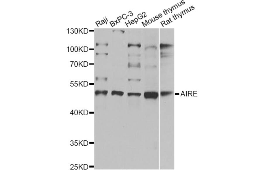 Western Blot - Anti-AIRE Antibody (A14183) - Antibodies.com