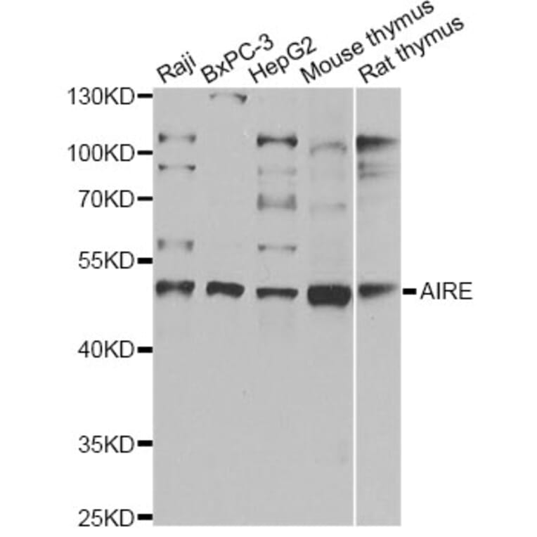 Western Blot - Anti-AIRE Antibody (A14183) - Antibodies.com