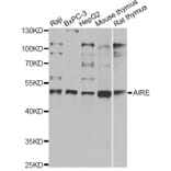 Western Blot - Anti-AIRE Antibody (A14183) - Antibodies.com
