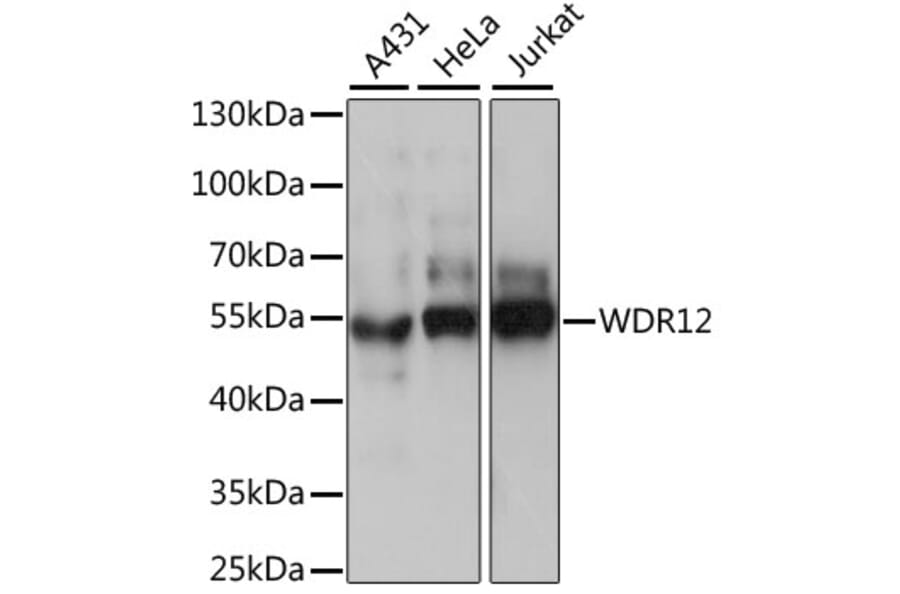 Western Blot - Anti-WDR12 Antibody (A90222) - Antibodies.com