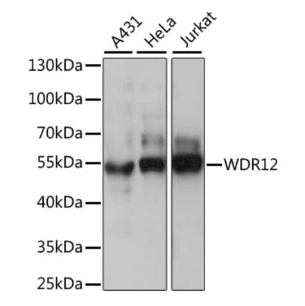 Western Blot - Anti-WDR12 Antibody (A90222) - Antibodies.com