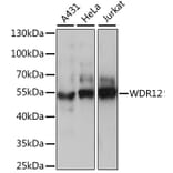 Western Blot - Anti-WDR12 Antibody (A90222) - Antibodies.com
