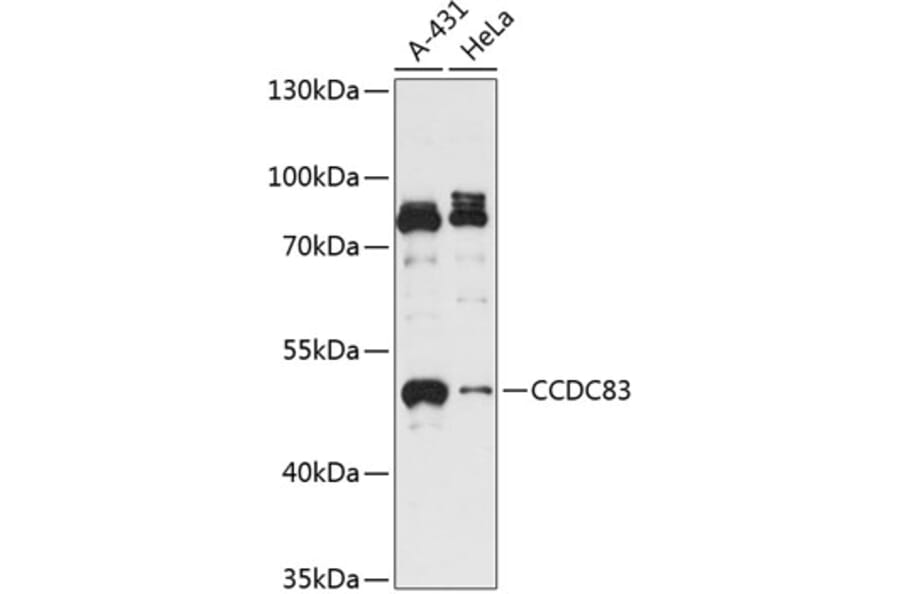 Western Blot - Anti-CCDC83 Antibody (A90223) - Antibodies.com