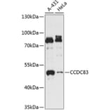Western Blot - Anti-CCDC83 Antibody (A90223) - Antibodies.com
