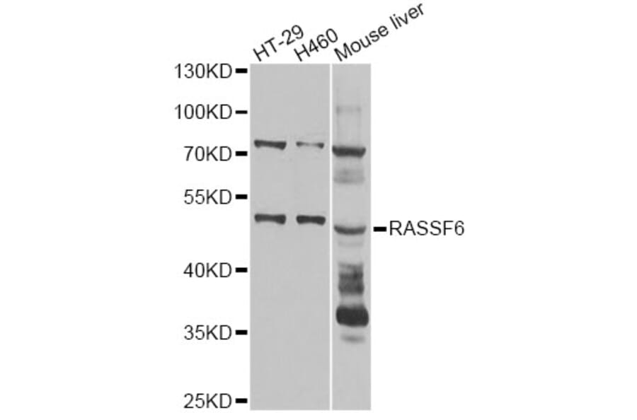 Western Blot - Anti-RASSF6 Antibody (A14163) - Antibodies.com