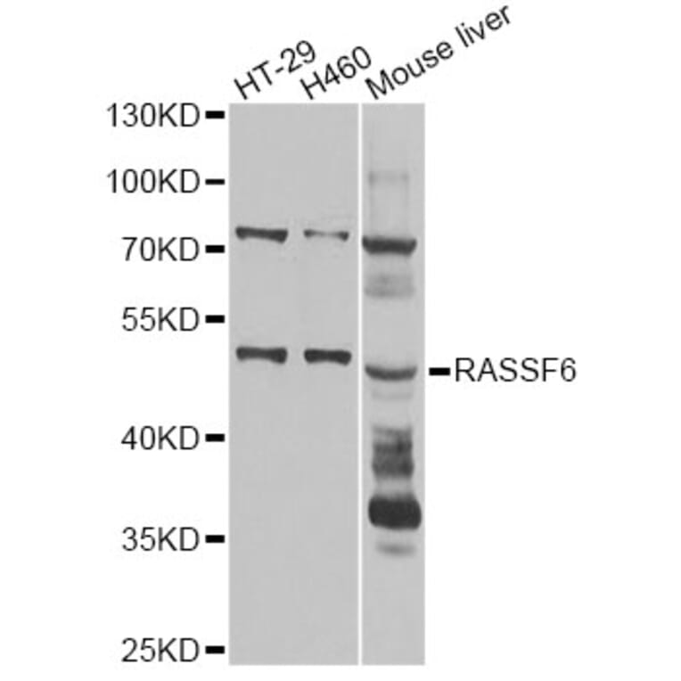 Western Blot - Anti-RASSF6 Antibody (A14163) - Antibodies.com