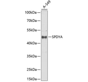 Western Blot - Anti-Spy1 Antibody (A90225) - Antibodies.com