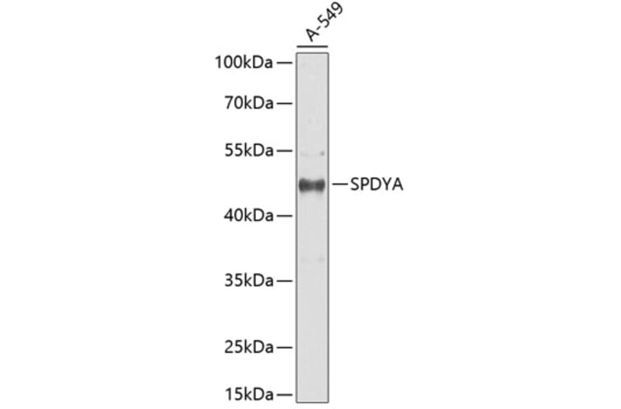 Western Blot - Anti-Spy1 Antibody (A90225) - Antibodies.com
