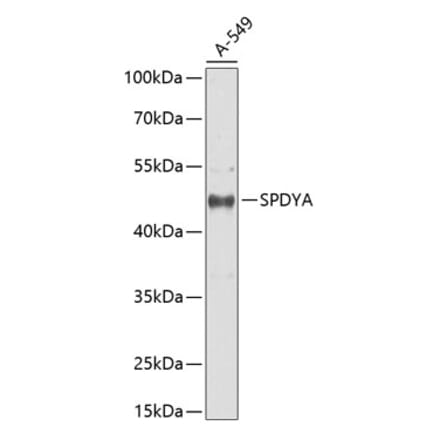 Western Blot - Anti-Spy1 Antibody (A90225) - Antibodies.com