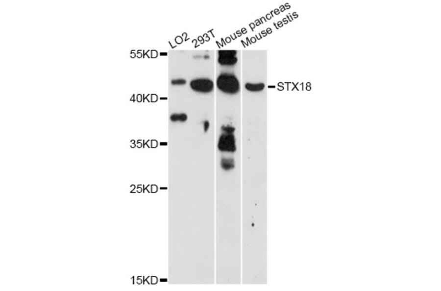 Western Blot - Anti-STX18 Antibody (A14368) - Antibodies.com