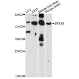 Western Blot - Anti-STX18 Antibody (A14368) - Antibodies.com