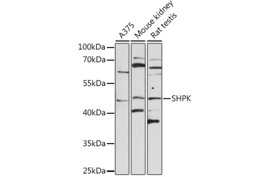 Western Blot - Anti-SHPK Antibody (A8823) - Antibodies.com