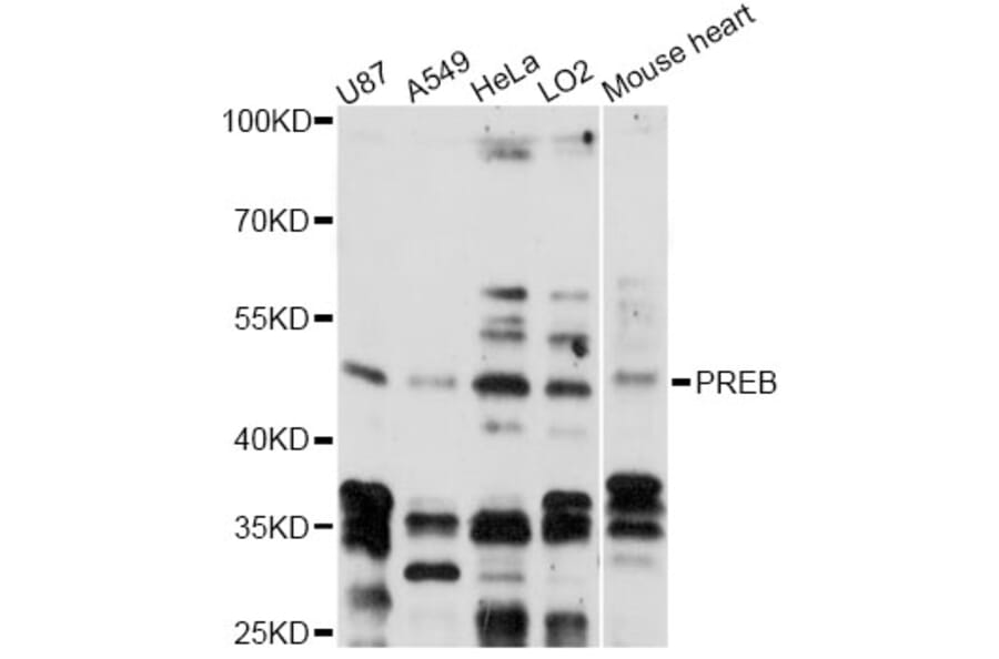 Western Blot - Anti-PREB Antibody (A14347) - Antibodies.com